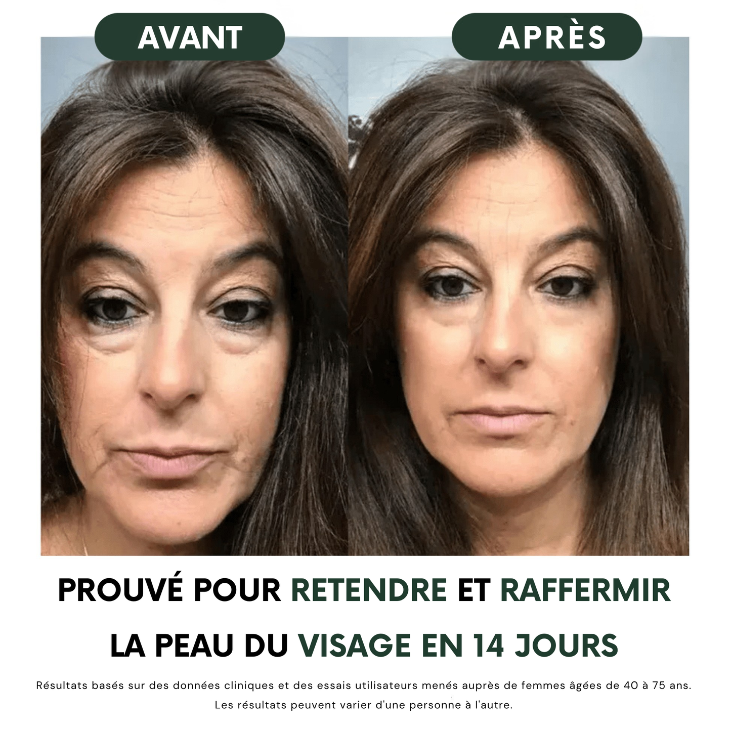 Brosse de drainage lymphatique