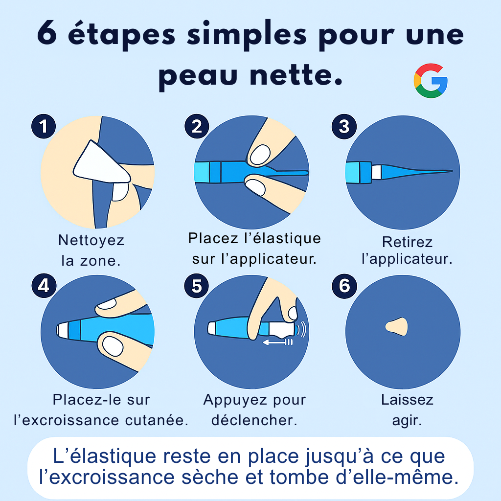 Zyricx™ Kit Complet – Fini les Excroissances Cutanées