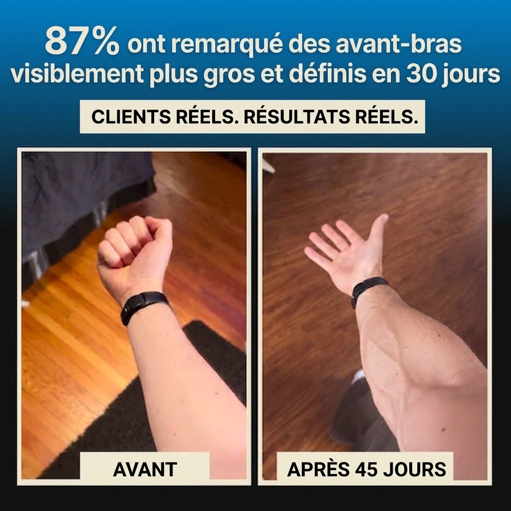 Renforceur d’Avant-Bras Zyricx™