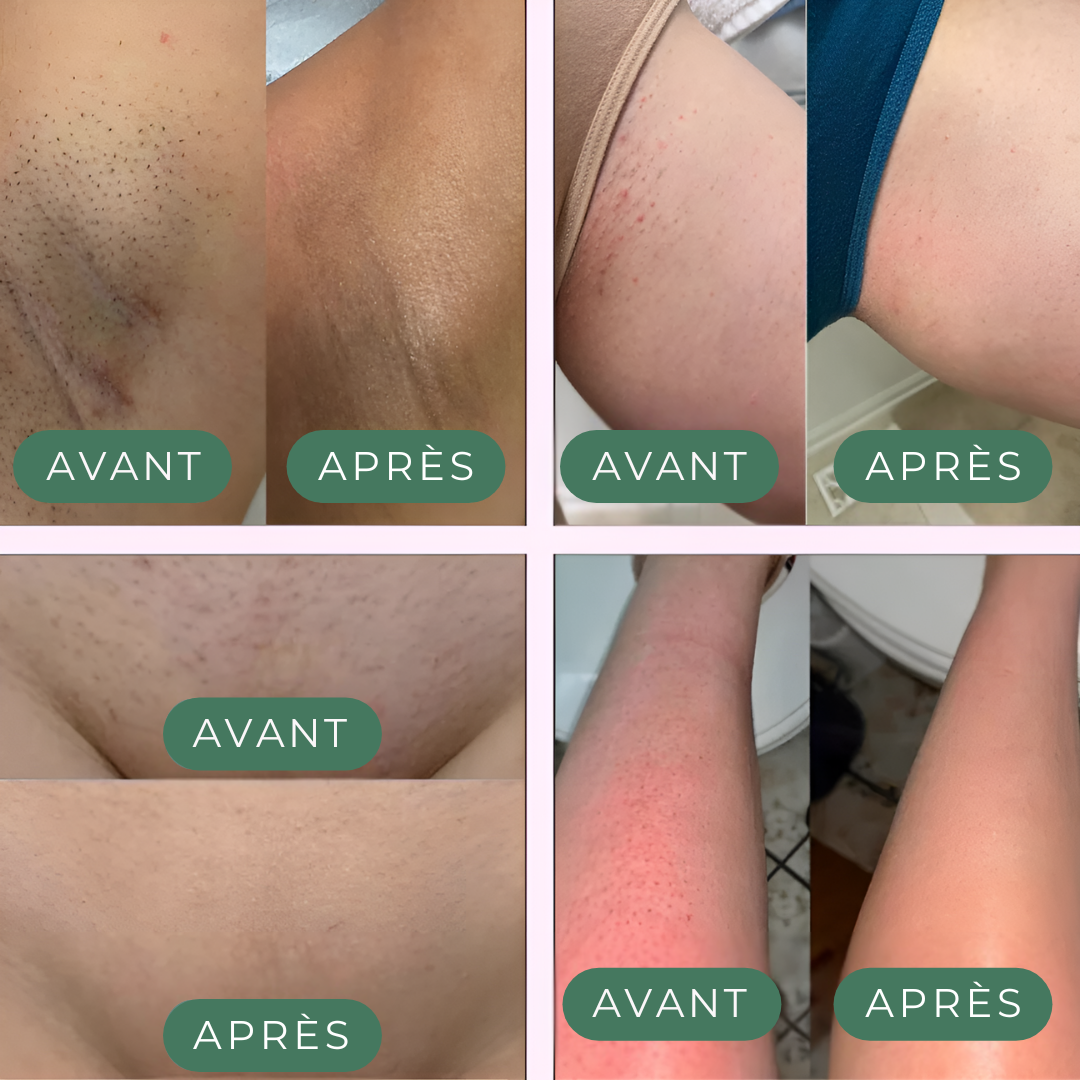 Glisse Pro – Épilateur Doux Sans Douleur