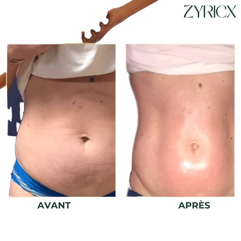 BodyRoller™ - Bâton de thérapie Gua Sha en bois