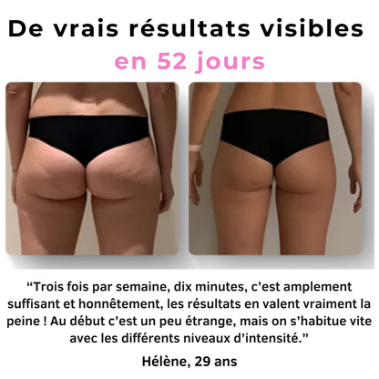 Zyricx™ Masseur Anti-Cellulite