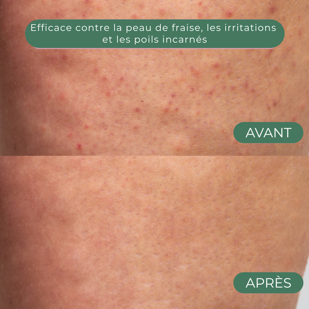 Glisse Pro – Épilateur Doux Sans Douleur