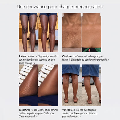 Le Perfecteur Corporel – Enrichi à l'Huile de Nigelle
