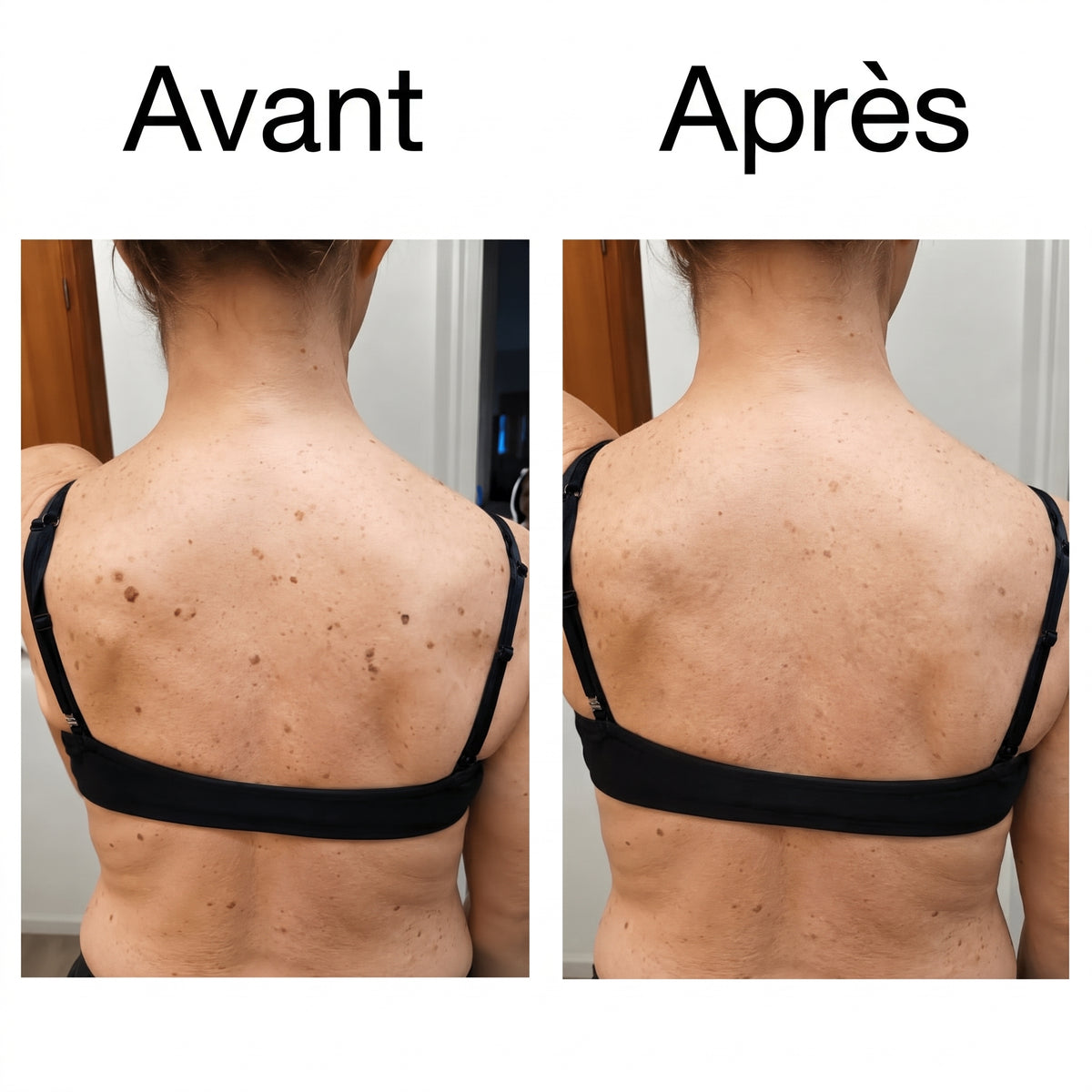 Stick Corporel Lissant à l'Acide Glycolique