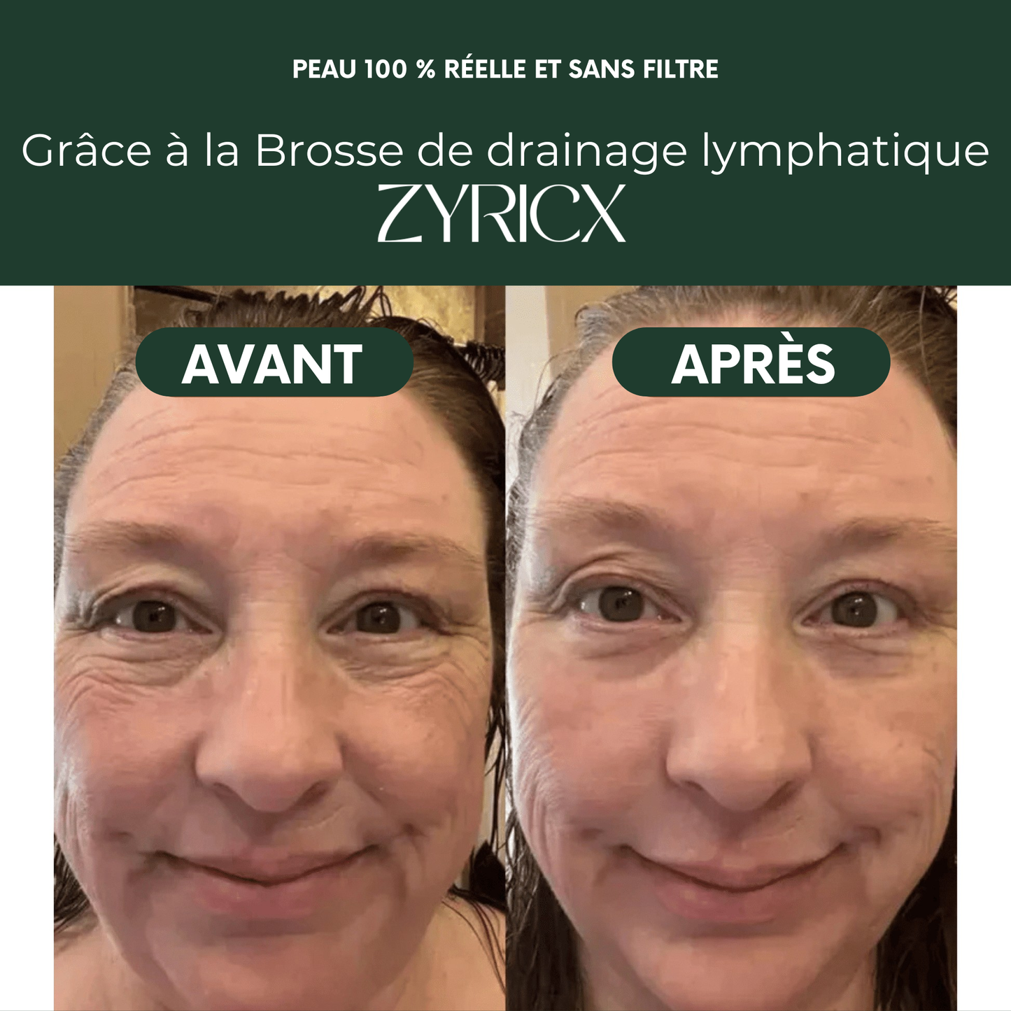 Brosse de drainage lymphatique