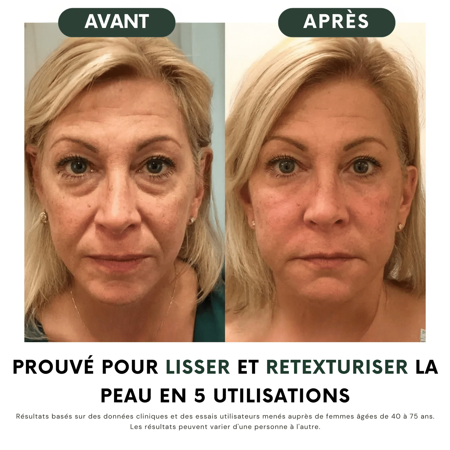 Brosse de drainage lymphatique