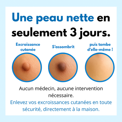 Zyricx™ Kit Complet – Fini les Excroissances Cutanées