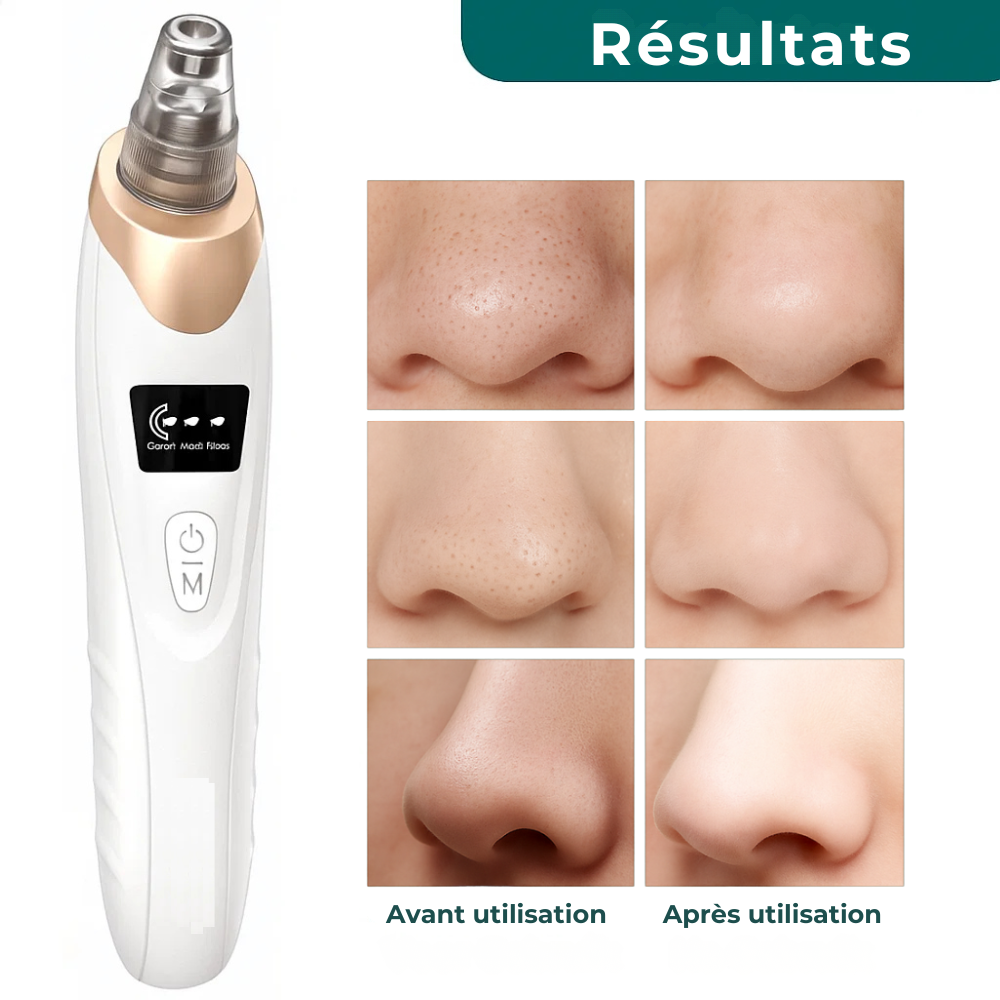 PorePurify™ – Nettoyeur de pores en profondeur