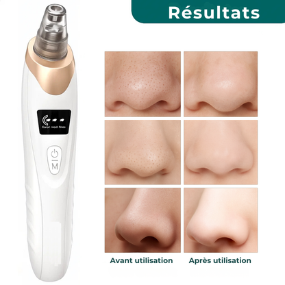 PorePurify™ – Nettoyeur de pores en profondeur