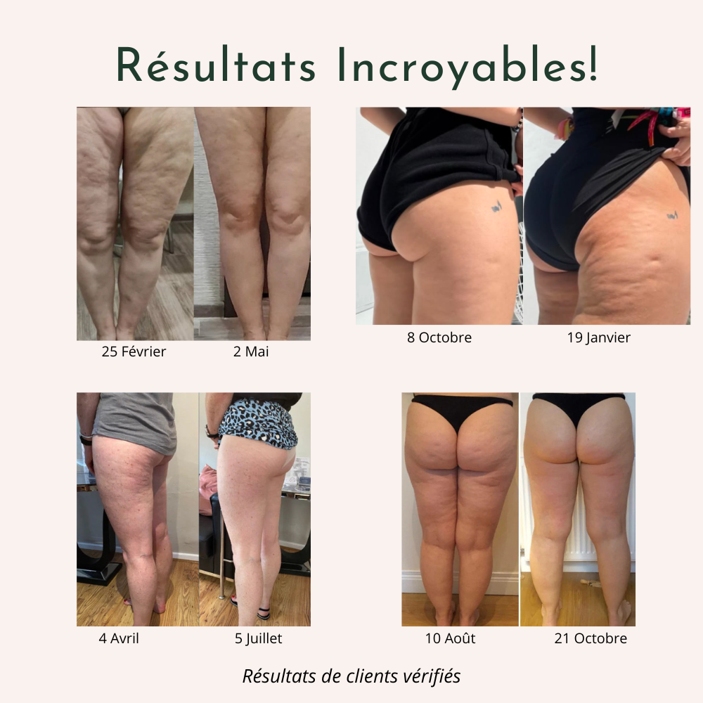 Legging 3D Anti-Cellulite