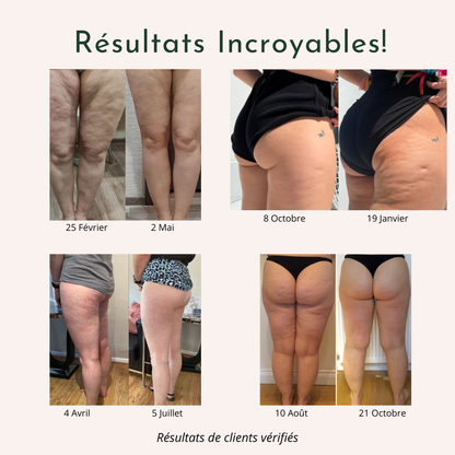 Legging 3D Anti-Cellulite