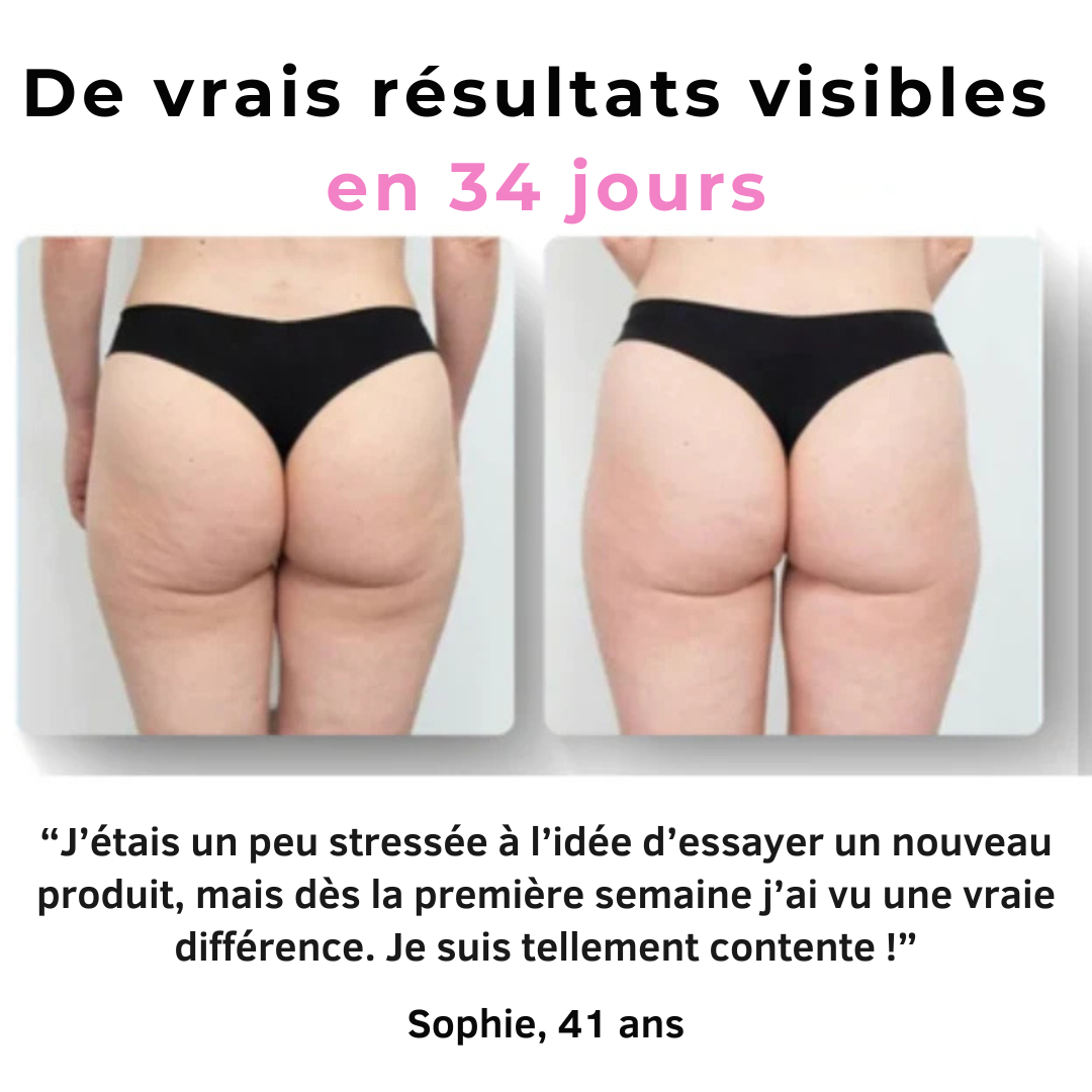 Zyricx™ Masseur Anti-Cellulite