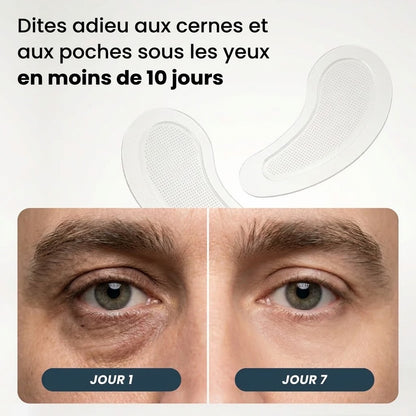 Patchs à micro-pointes pour le contour des yeux