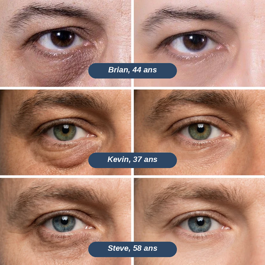 Patchs à micro-pointes pour le contour des yeux